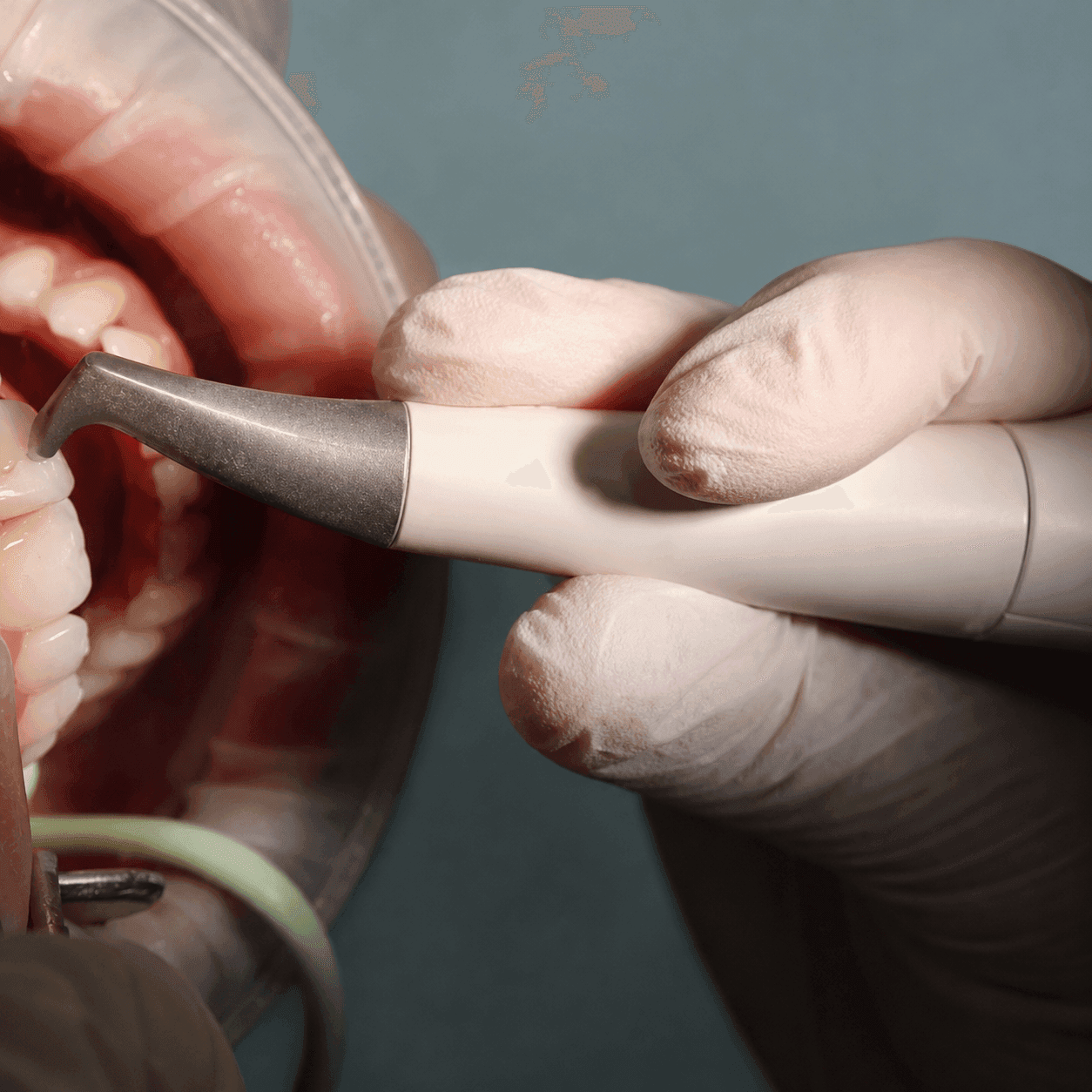 Why are Hygiene Visits Important?