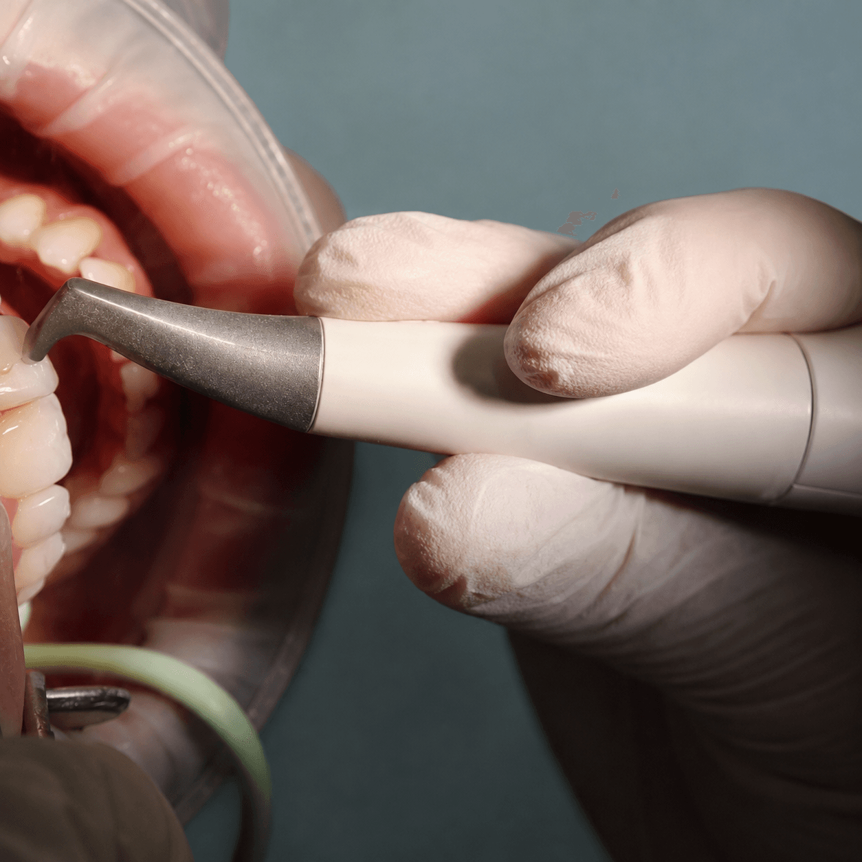Why are Hygiene Visits Important?
